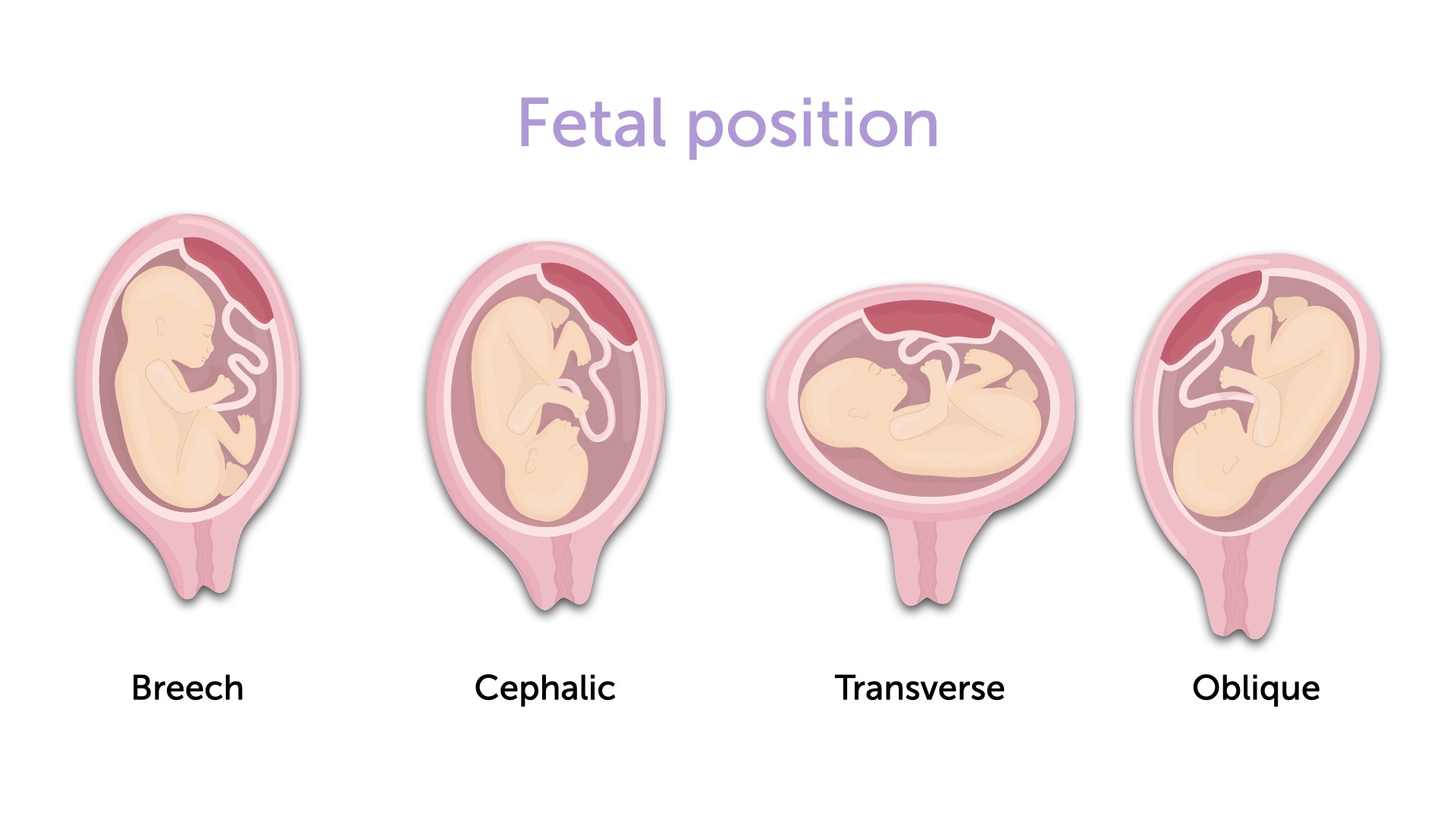 fetal presentation and position ultrasound