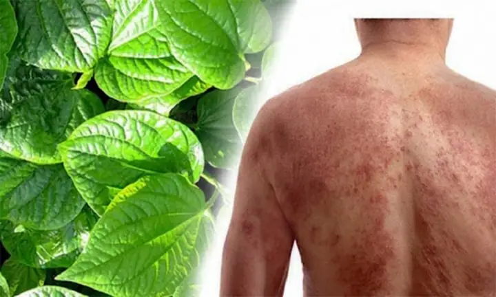 Các Loại Lá Tắm Trị Ngứa Cho Bé An Toàn Và Hiệu Quả Nhất