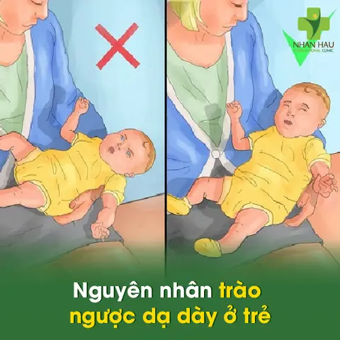 10+ Cách Chữa Trào Ngược Dạ Dày Cho Bé An Toàn, Hiệu Quả Tại Nhà