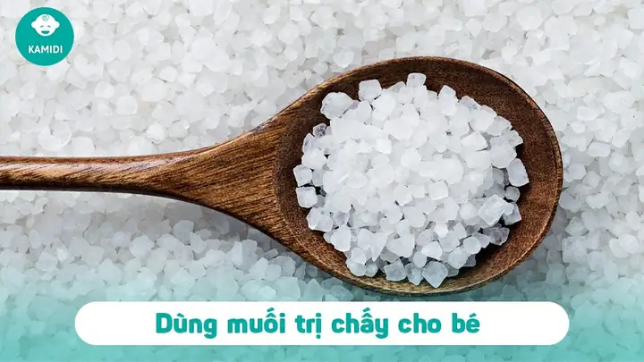 Cách Diệt Chấy Cho Bé An Toàn, Hiệu Quả Tại Nhà Cho Mẹ Cách Diệt Chấy Cho Bé An Toàn, Hiệu Quả Tại Nhà Cho Mẹ