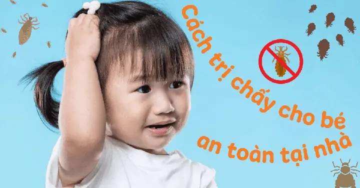Cách Diệt Chấy Cho Bé An Toàn, Hiệu Quả Tại Nhà Cho Mẹ Cách Diệt Chấy Cho Bé An Toàn, Hiệu Quả Tại Nhà Cho Mẹ