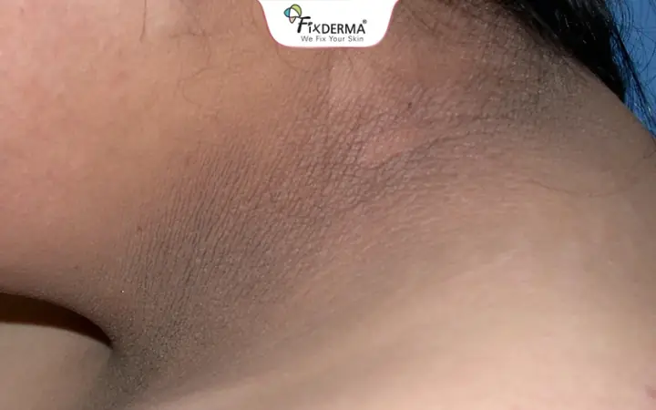 Khắc Phục Tình Trạng Cô Bé Khô Hạn: Nguyên Nhân, Dấu Hiệu Và Giải Pháp Toàn Diện 1 Khắc Phục Tình Trạng Cô Bé Khô Hạn: Nguyên Nhân, Dấu Hiệu Và Giải Pháp Toàn Diện