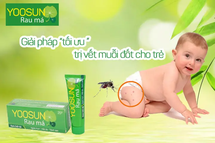 Cách Làm Dịu Vết Muỗi Đốt Cho Bé Nhanh Chóng & An Toàn Tại Nhà