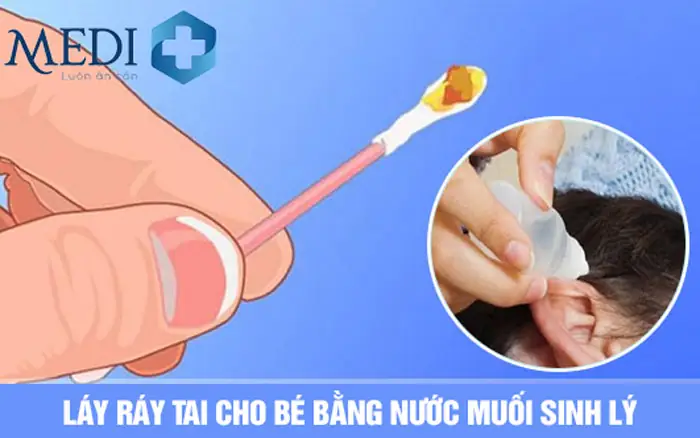 Cách Lấy Ráy Tai Khô Cho Bé An Toàn Và Hiệu Quả Tại Nhà