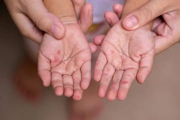Cách May Bao Chân Cho Bé Sơ Sinh Đơn Giản Tại Nhà