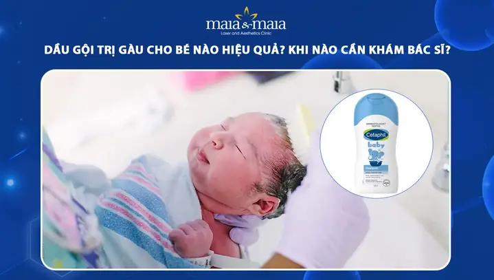 Cách Trị Gàu Cho Bé An Toàn, Hiệu Quả Tại Nhà (nguyên Nhân & Giải Pháp Tự Nhiên) Cách Trị Gàu Cho Bé An Toàn, Hiệu Quả Tại Nhà (nguyên Nhân & Giải Pháp Tự Nhiên)
