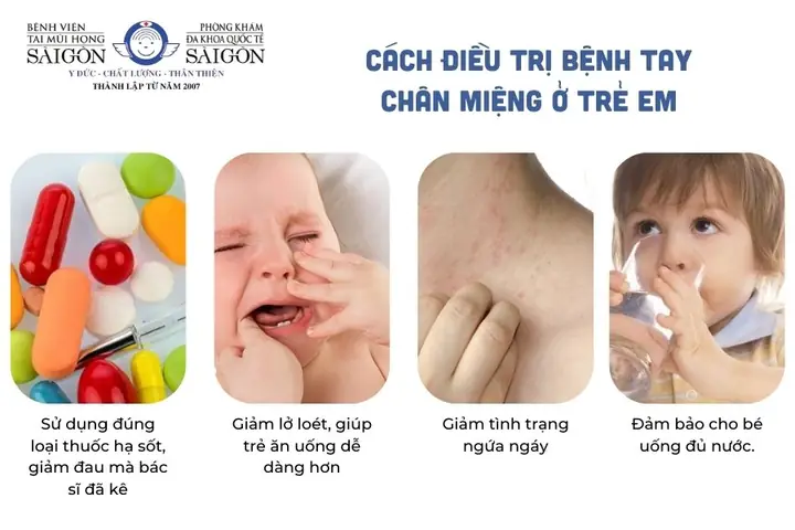 10+ Cách Trị Lở Miệng Cho Bé An Toàn, Nhanh Khỏi Tại Nhà