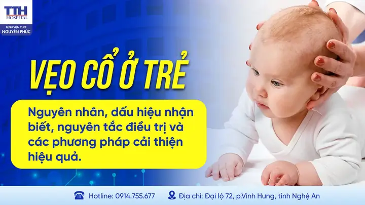 Cách Trị Vẹo Cổ Cho Bé An Toàn Và Hiệu Quả Tại Nhà Cách Trị Vẹo Cổ Cho Bé An Toàn Và Hiệu Quả Tại Nhà