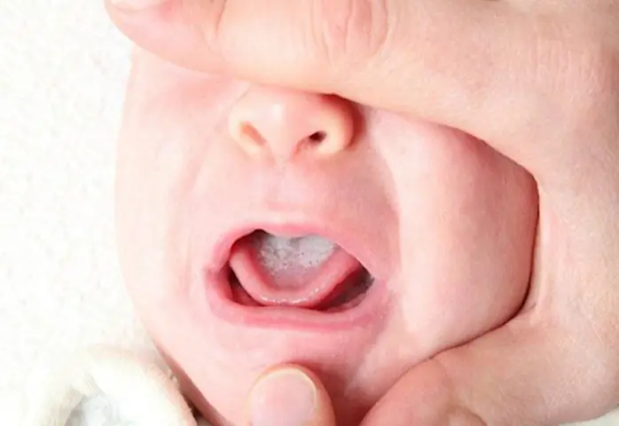 Cách Rơ Lưỡi Cho Bé Sơ Sinh Đúng Cách: An Toàn & Hiệu Quả Tại Nhà