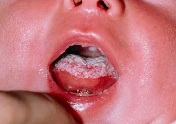 Hướng Dẫn Chi Tiết Cách Vệ Sinh Lưỡi Cho Bé Sơ Sinh An Toàn & Hiệu Quả