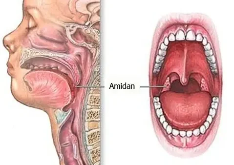 Địa Chỉ Cắt Amidan Cho Bé An Toàn, Hiệu Quả Ở Đâu Tốt Nhất?