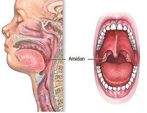 Địa Chỉ Cắt Amidan Cho Bé An Toàn, Hiệu Quả Ở Đâu Tốt Nhất?