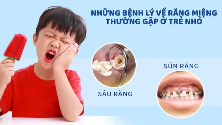 Chăm Sóc Răng Miệng Cho Bé 1 Tuổi: Hướng Dẫn Chi Tiết Từ A-z