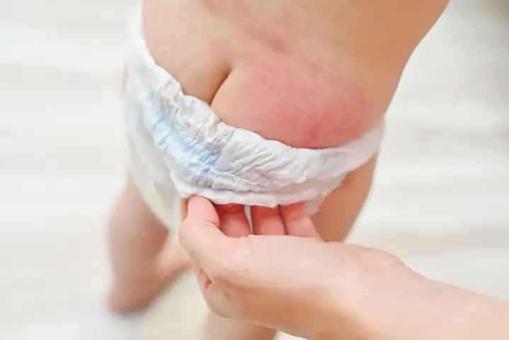 Khi Nào Nên Cai Tã/bỉm Cho Bé: Hướng Dẫn Chi Tiết Cho Cha Mẹ Khi Nào Nên Cai Tã/bỉm Cho Bé: Hướng Dẫn Chi Tiết Cho Cha Mẹ