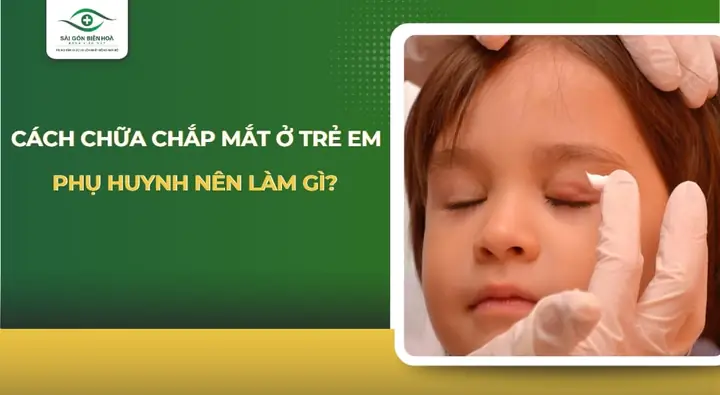 Chắp Mắt Ở Trẻ: Nguyên Nhân, Dấu Hiệu Và Cách Chữa Trị An Toàn Tại Nhà