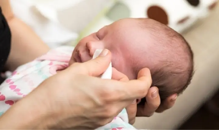 Chữa Mắt Lẹo Cho Bé: Nguyên Nhân, Cách Điều Trị An Toàn & Phòng Ngừa