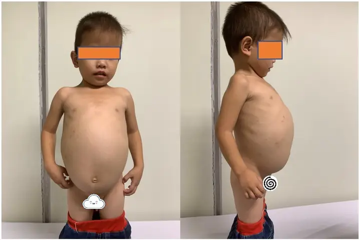 Chụp Đại Tràng Cho Bé: Khi Nào Cần Thiết, Quy Trình Và Lưu Ý Quan Trọng