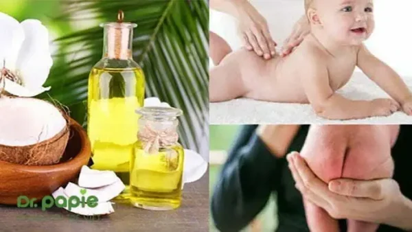 Dầu Dừa Trị Hăm Tã Cho Bé: Hướng Dẫn Chi Tiết Và Lưu Ý Quan Trọng
