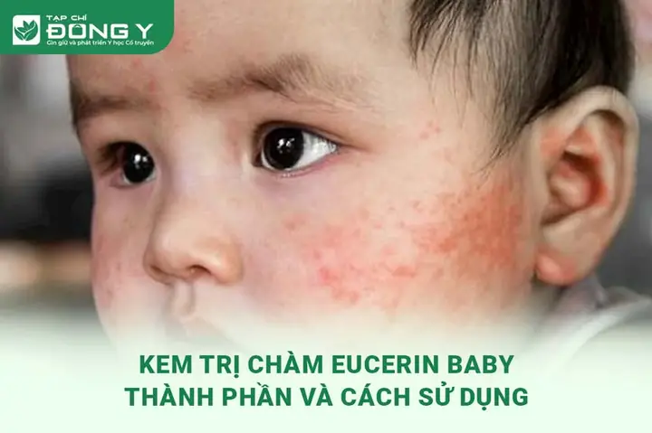 Eucerin Trị Chàm Cho Bé: Hướng Dẫn Chọn Kem, Thành Phần & Cách Dùng Hiệu Quả Eucerin Trị Chàm Cho Bé: Hướng Dẫn Chọn Kem, Thành Phần & Cách Dùng Hiệu Quả