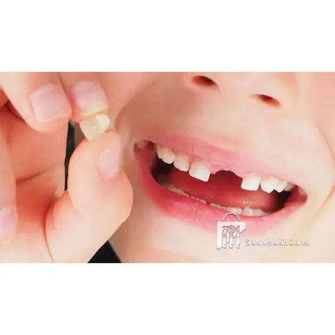 Hộp Đựng Răng Sữa Cho Bé: Lưu Giữ Kỷ Niệm Tuổi Thơ Ý Nghĩa Hộp Đựng Răng Sữa Cho Bé: Lưu Giữ Kỷ Niệm Tuổi Thơ Ý Nghĩa
