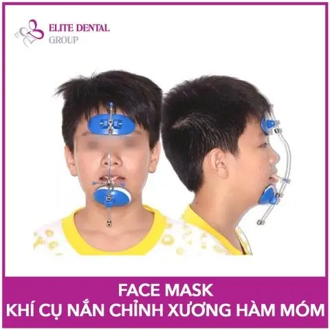 Khí Cụ Chỉnh Nha Cho Bé: Các Loại, Lợi Ích Và Thời Điểm Vàng Sử Dụng Khí Cụ Chỉnh Nha Cho Bé: Các Loại, Lợi Ích Và Thời Điểm Vàng Sử Dụng