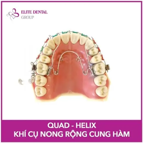 Khí Cụ Chỉnh Nha Cho Bé: Các Loại, Lợi Ích Và Thời Điểm Vàng Sử Dụng Khí Cụ Chỉnh Nha Cho Bé: Các Loại, Lợi Ích Và Thời Điểm Vàng Sử Dụng