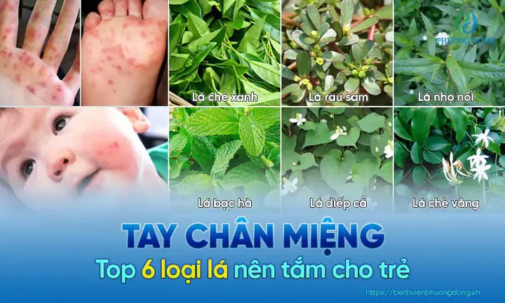 Lá Tắm Cho Bé Bị Tay Chân Miệng: Loại Lá Nào Tốt Nhất & Cách Dùng An Toàn Lá Tắm Cho Bé Bị Tay Chân Miệng: Loại Lá Nào Tốt Nhất & Cách Dùng An Toàn