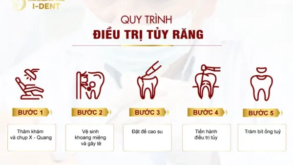 Trẻ Em Có Nên Lấy Tủy Răng Không? Quy Trình & Lợi Ích Bảo Tồn