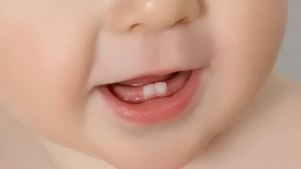 Lịch Mọc Răng Của Bé: Thứ Tự, Dấu Hiệu Và Khi Nào Cần Lo Lắng?
