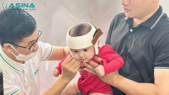 Mũ Chỉnh Đầu Tròn Cho Bé: Giải Pháp An Toàn & Hiệu Quả Cho Trẻ Méo Đầu, Bẹt Đầu